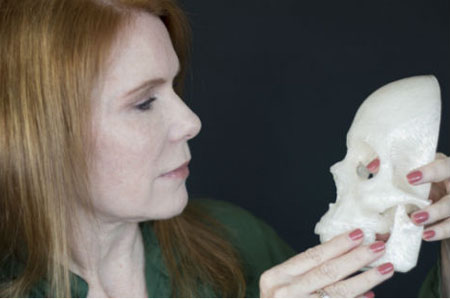 技术宅用3D打印帮助妻子治疗脑瘤